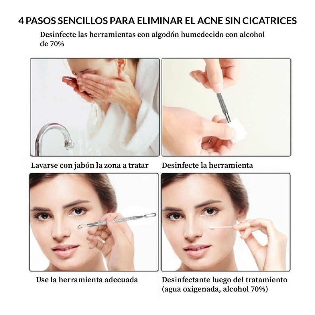 Agujas para el Acné – Juego Súper de 4 Piezas