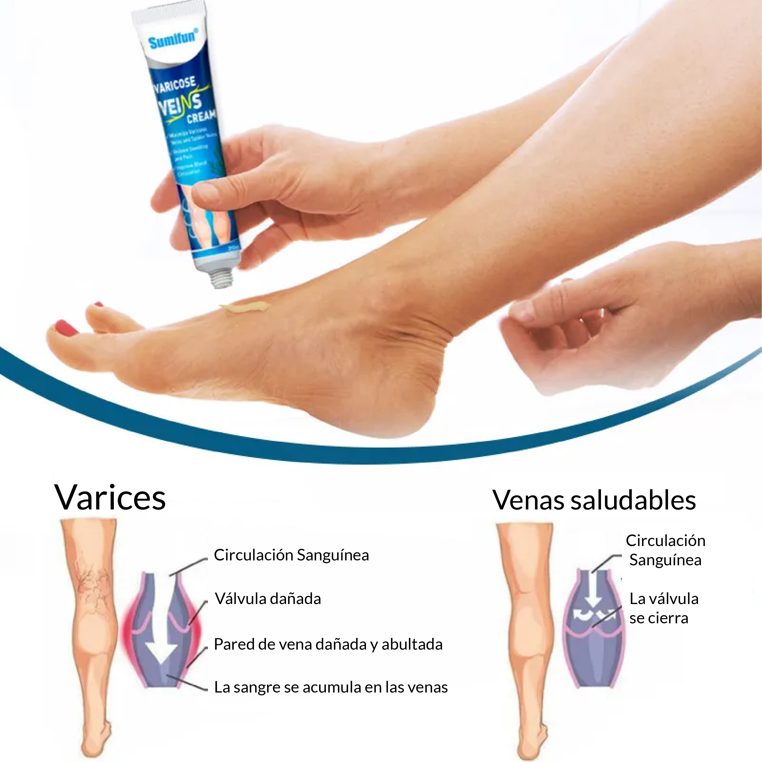 Crema de Venas Varicosas - Semifun 20g