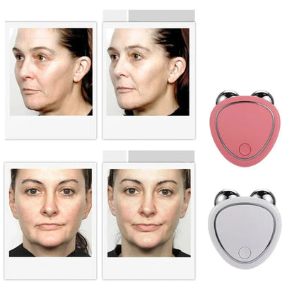 MASAJEADOR FACIAL ELECTRONICO, CON MICROCORRIENTE