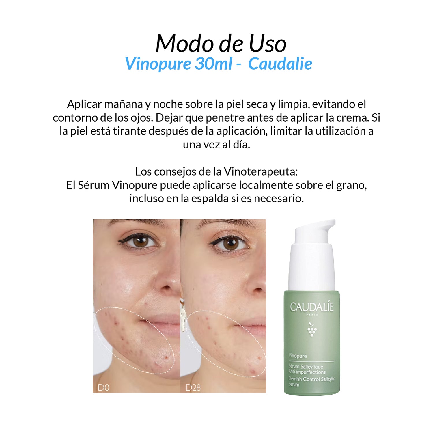 Vinopure 30ml- Caudalie