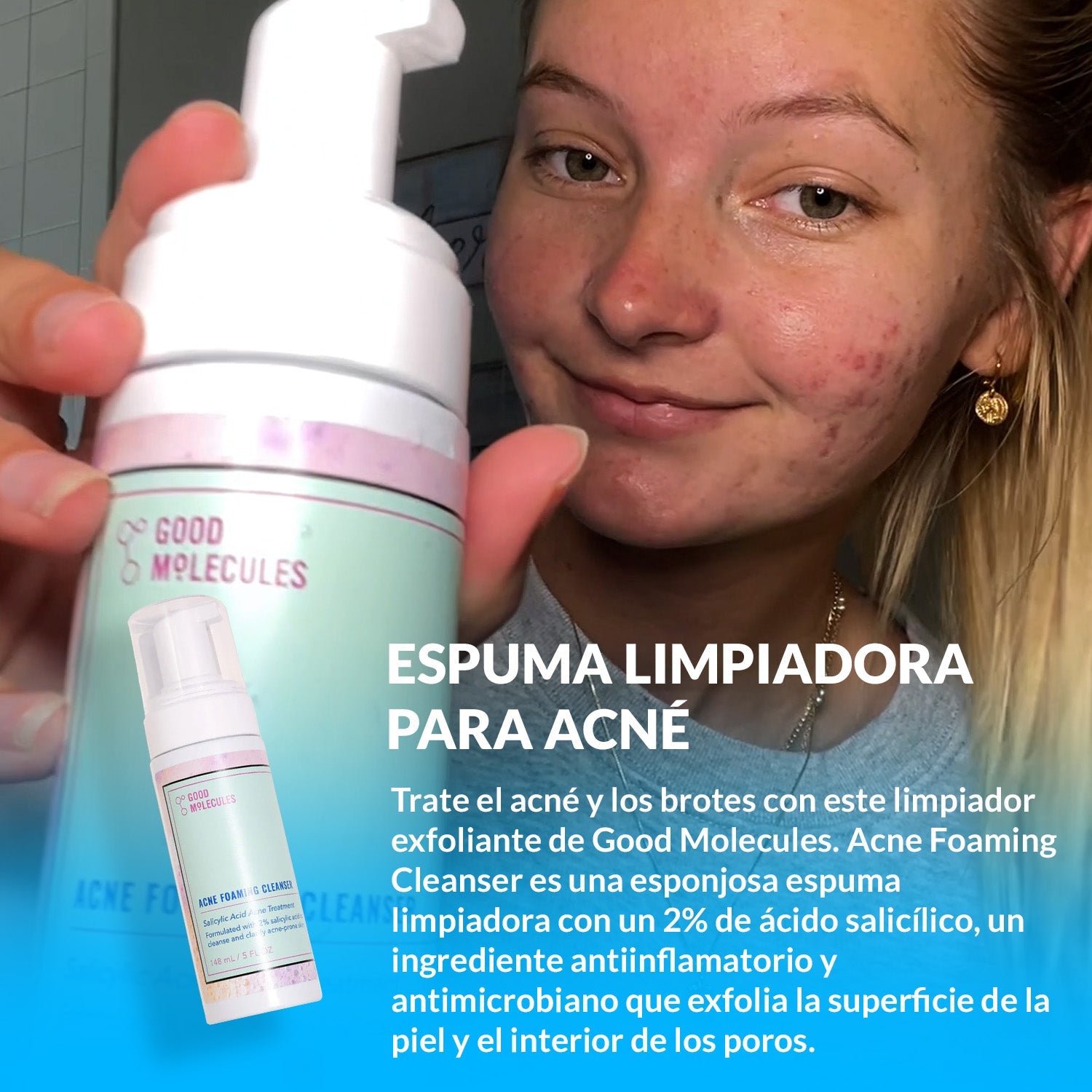 Espuma limpiadora para Acné - Good Molecules 148ml