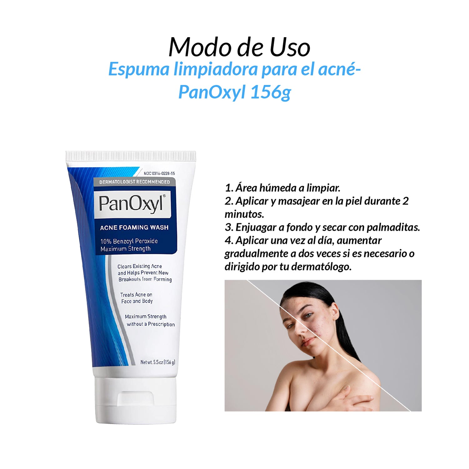 Foaming Acne Wash Maximum Strength 10% Benzoyl Peroxide - PanOxyl 156 gr